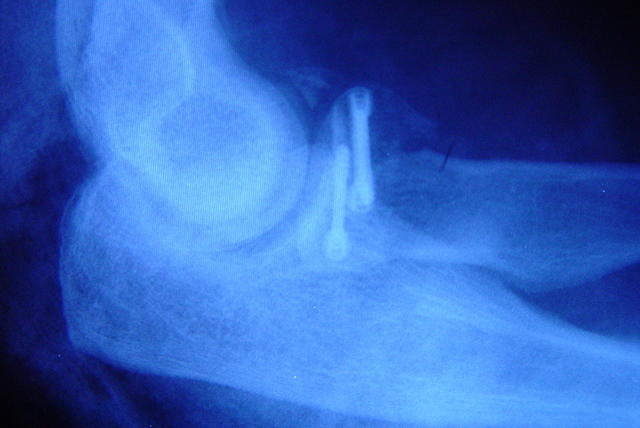 dsc00391